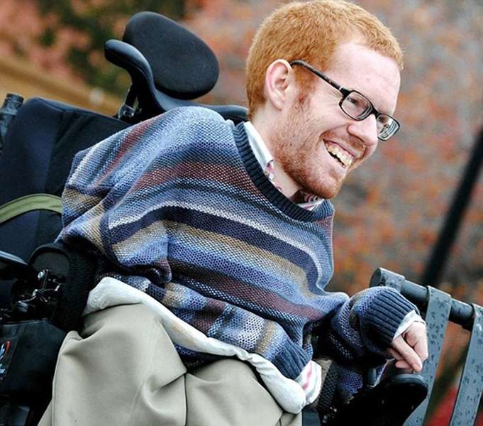 Charcot – Marie – Tooth - Hình ảnh minh họa